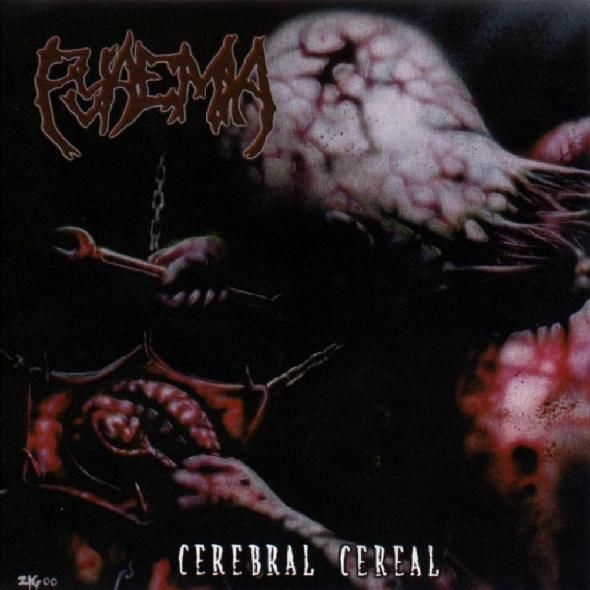cerebral cereal pyaemia 