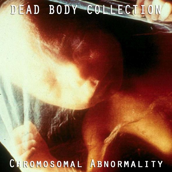 chromosomal abnormal dead body collection  
