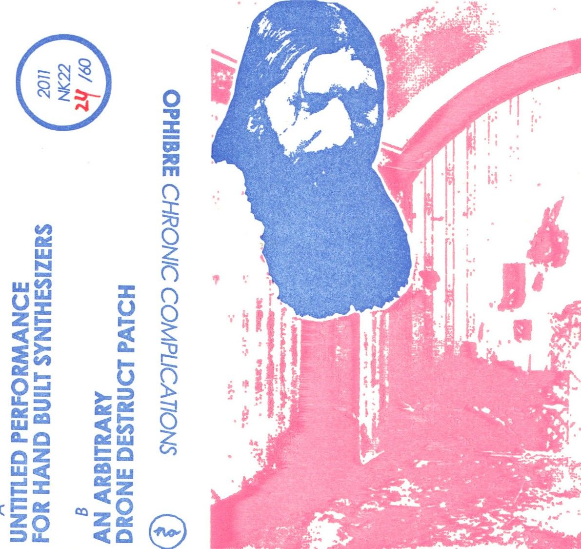 chronic complication ophibre  