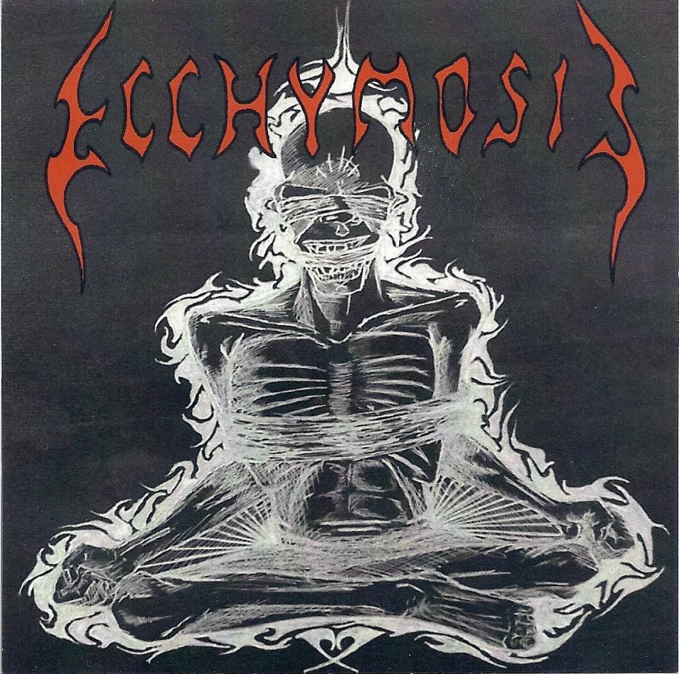 ecchymosis ecchymosis 