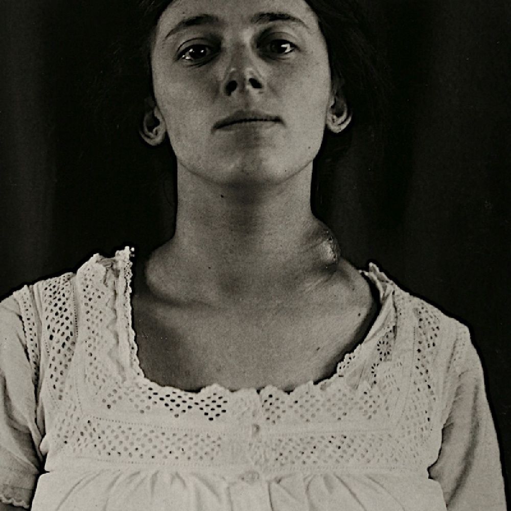 schizophrenic the final harsh work 