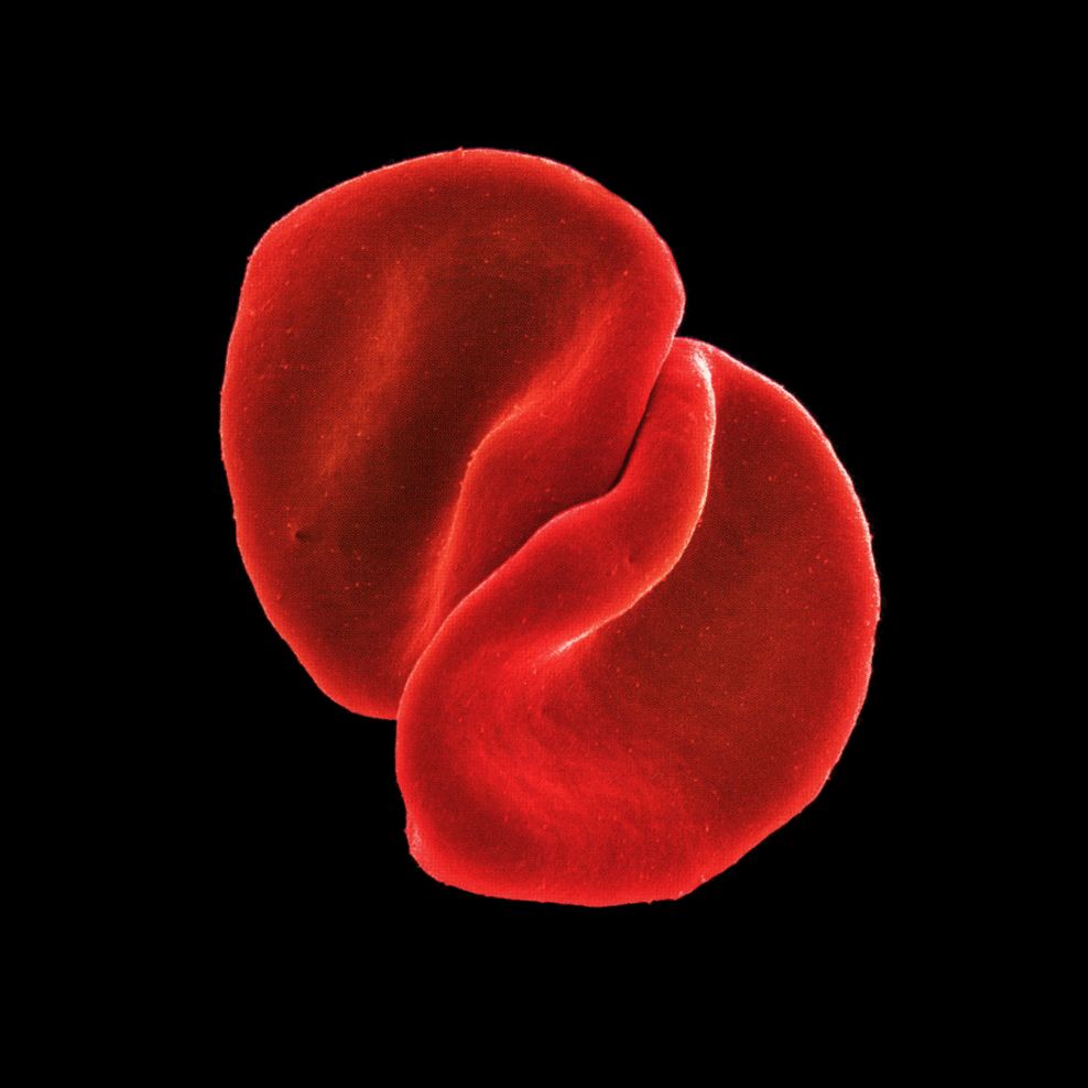 scratch my back peter gabriel 