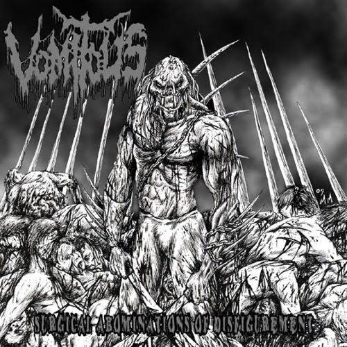 surgical abomination vomitous 