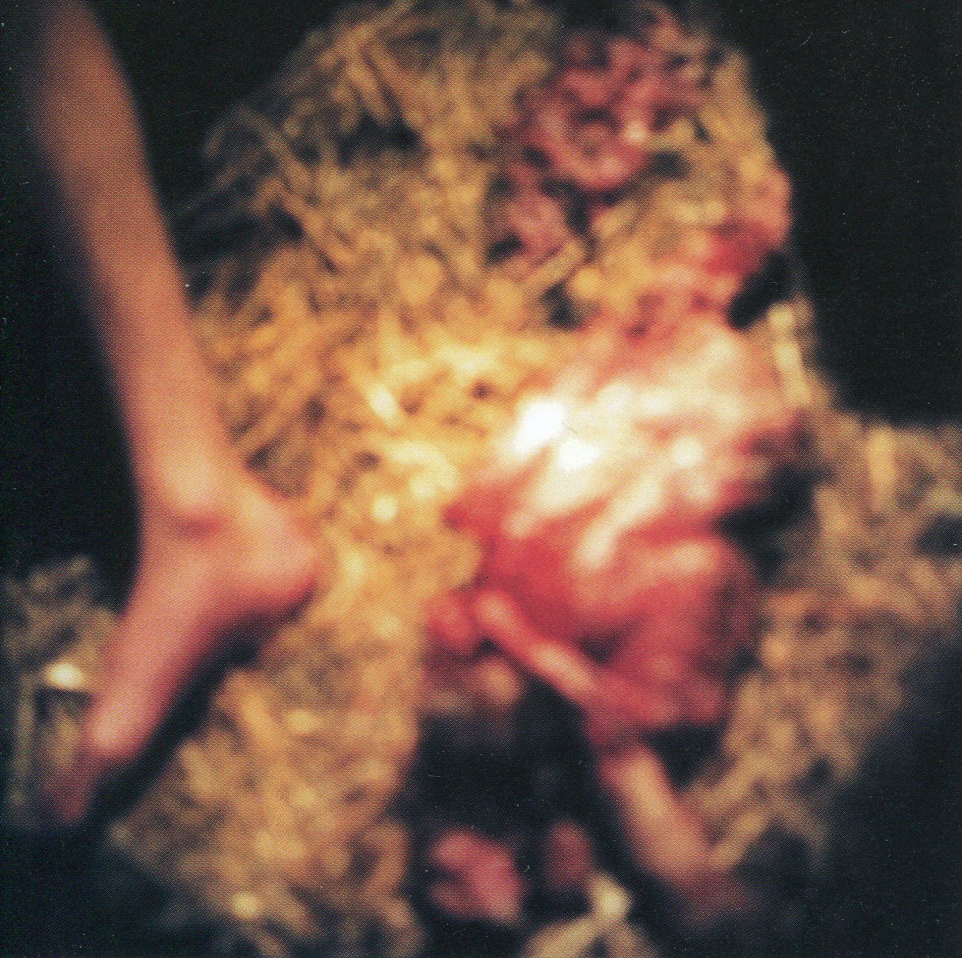 surgical transfusion fen 