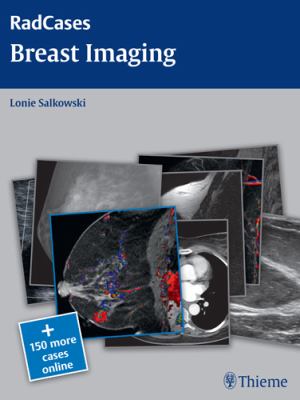 Breast Imaging Salkowski 