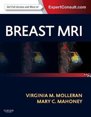 Breast MRI Expert Consult Molleran MD PhD 