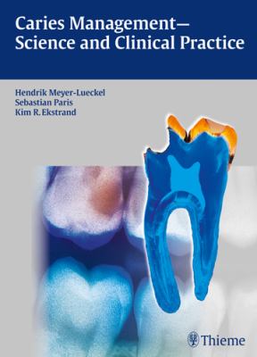 Caries Management Science and Clinical Practice Ekstrand Kim R 