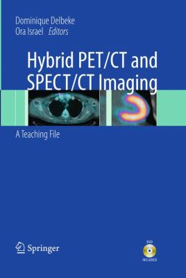 Hybrid Pet CT and Spect CT Imaging Delbeke Dominique 