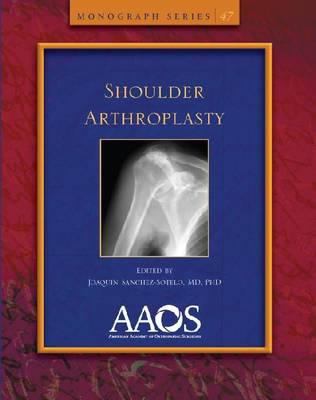 Shoulder Arthroplasty SANCHEZ SOTELO 