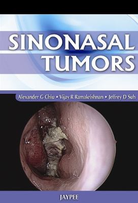 Sinonasal Tumors Chiu Alexander G 
