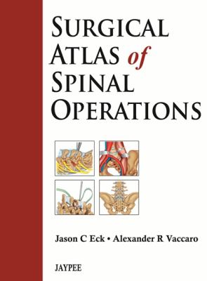 Surgical Atlas of Spinal Operations 
